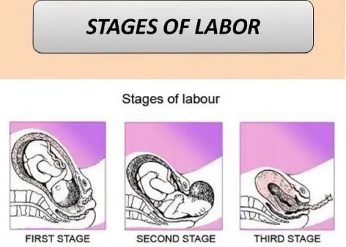 What Are the Stages of Labor?