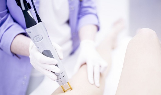 Does Laser Hair Removal Affect Pregnancy
